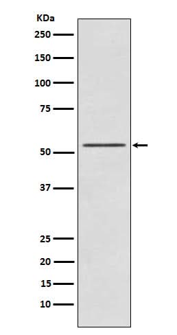 Anti-P70 S6 Kinase beta Rabbit Monoclonal Antibody Boster Bio