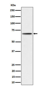 Anti-Phospho-P70 S6 Kinase beta (S371) Rabbit Monoclonal Antibody Boster Bio