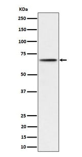 Anti-Phospho-P70 S6 Kinase beta (S371) Rabbit Monoclonal Antibody Boster Bio