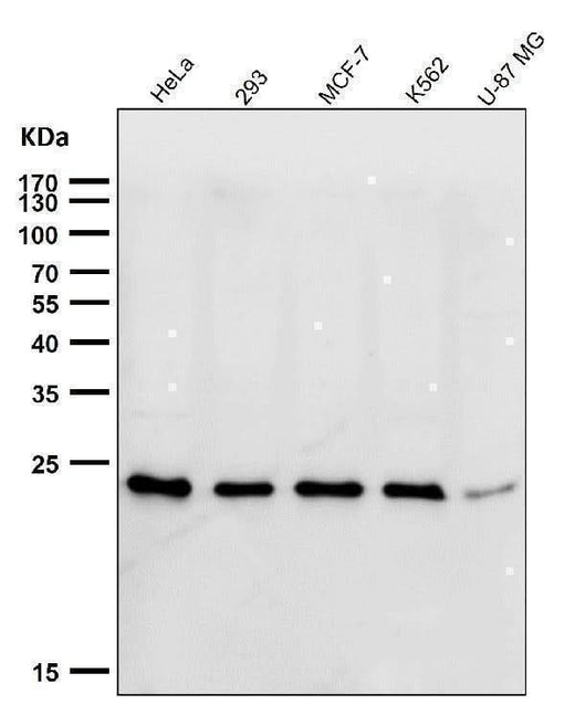 Anti-HSPC150 Rabbit Monoclonal Antibody Boster Bio