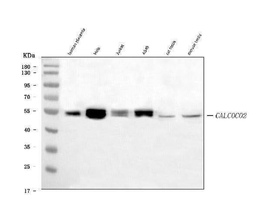 Anti-NDP52/CALCOCO2 Antibody Picoband® (monoclonal, 9E2F2 Boster Bio