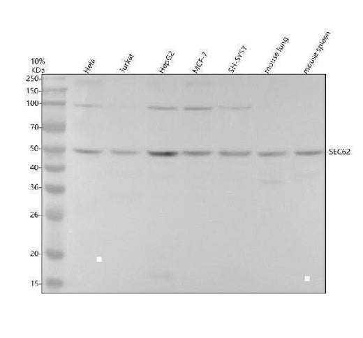 Anti-SEC62 Rabbit Monoclonal Antibody Boster Bio