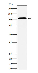 Anti-USO1 Rabbit Monoclonal Antibody Boster Bio