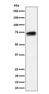 Anti-SSX2IP Rabbit Monoclonal Antibody Boster Bio