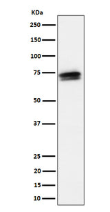 Anti-SSX2IP Rabbit Monoclonal Antibody Boster Bio