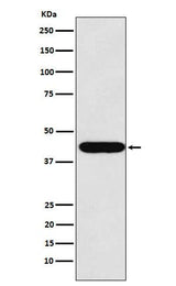 Anti-LHX2 Rabbit Monoclonal Antibody Boster Bio