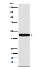 Anti-LHX2 Rabbit Monoclonal Antibody Boster Bio