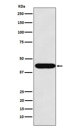 Anti-LHX2 Rabbit Monoclonal Antibody Boster Bio