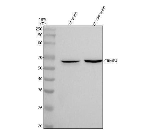Anti-CRMP4 Rabbit Monoclonal Antibody Boster Bio
