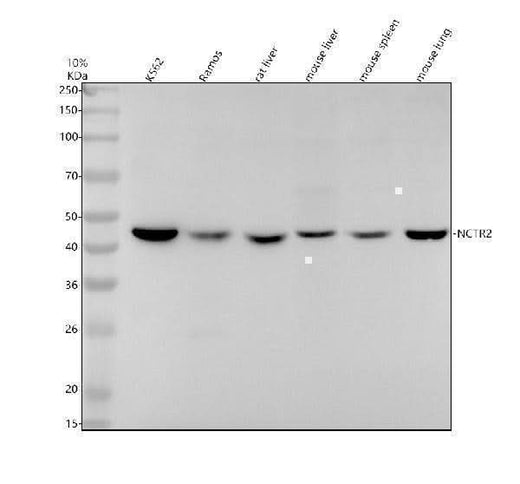 Anti-NCTR2 Rabbit Monoclonal Antibody Boster Bio