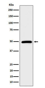 Anti-AMSH Rabbit Monoclonal Antibody Boster Bio