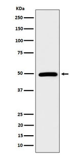 Anti-AMSH Rabbit Monoclonal Antibody Boster Bio