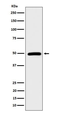 Anti-AMSH Rabbit Monoclonal Antibody Boster Bio