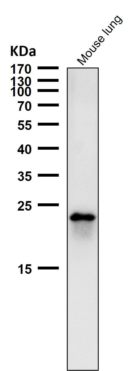 Anti-RAB22A Rabbit Monoclonal Antibody Boster Bio