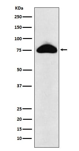 Anti-CD66b Rabbit Monoclonal Antibody Boster Bio