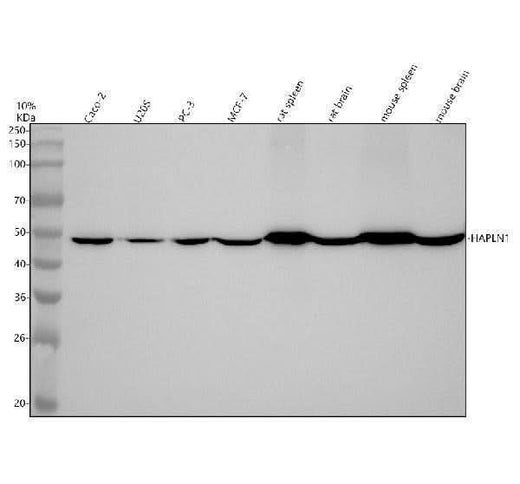 Anti-HAPLN1 Rabbit Monoclonal Antibody Boster Bio