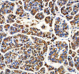 Anti-Carboxypeptidase A1+A2+B Rabbit Monoclonal Antibody Boster Bio