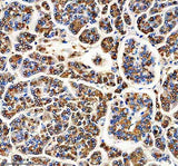 Anti-Carboxypeptidase A1+A2+B Rabbit Monoclonal Antibody Boster Bio