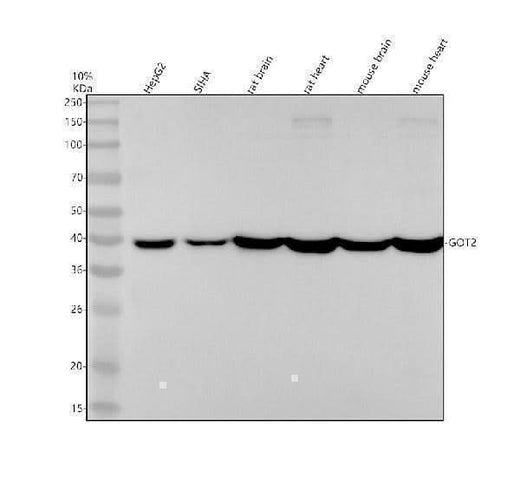 Anti-GOT2 Rabbit Monoclonal Antibody Boster Bio