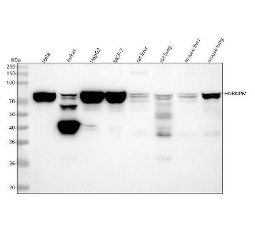 Anti-HNRNPM Rabbit Monoclonal Antibody Boster Bio