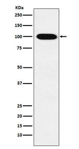 Anti-VPS18 Rabbit Monoclonal Antibody Boster Bio