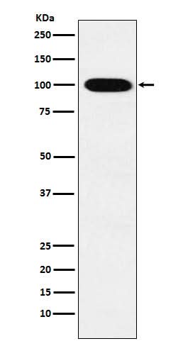 Anti-VPS18 Rabbit Monoclonal Antibody Boster Bio