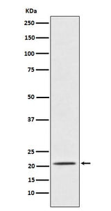 Anti-Placental Protein 14 / PAEP Rabbit Monoclonal Antibody Boster Bio