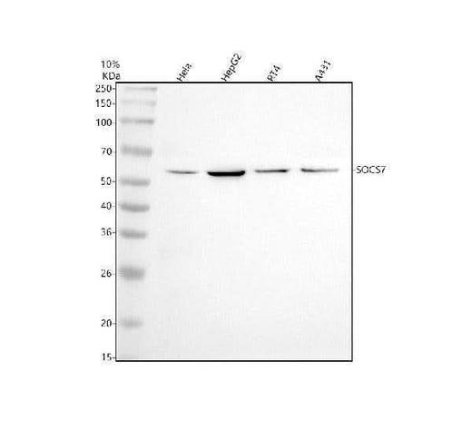 Anti-SOCS7 Rabbit Monoclonal Antibody Boster Bio