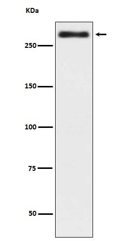 Anti-Talin 2 TLN2 Rabbit Monoclonal Antibody Boster Bio