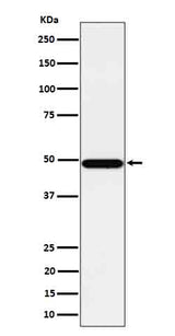 Anti-Tbp7 Rabbit Monoclonal Antibody Boster Bio