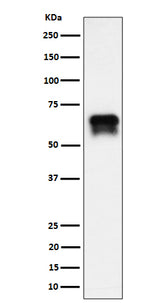 Anti-PCTAIRE1 Rabbit Monoclonal Antibody Boster Bio