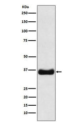 Anti-Olig1 Rabbit Monoclonal Antibody Boster Bio
