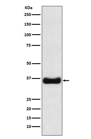 Anti-Olig1 Rabbit Monoclonal Antibody Boster Bio