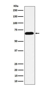 Anti-Alkaline phosphatase ALPI Rabbit Monoclonal Antibody Boster Bio