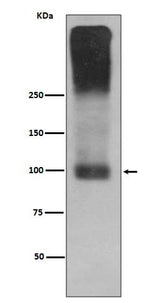 Anti-mGluR2 GRM2 Rabbit Monoclonal Antibody Boster Bio