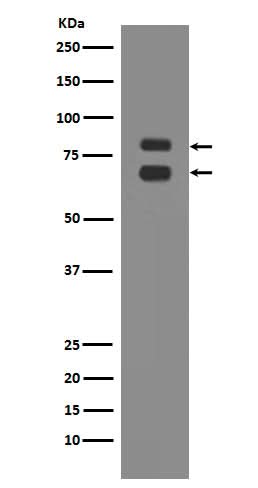 Anti-ASH2L Rabbit Monoclonal Antibody Boster Bio