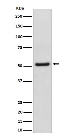 Anti-NUP50 Rabbit Monoclonal Antibody Boster Bio