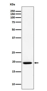 Anti-UFC1 Rabbit Monoclonal Antibody Boster Bio