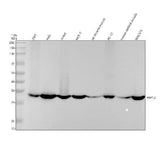 Anti-ARPC2 Rabbit Monoclonal Antibody Boster Bio