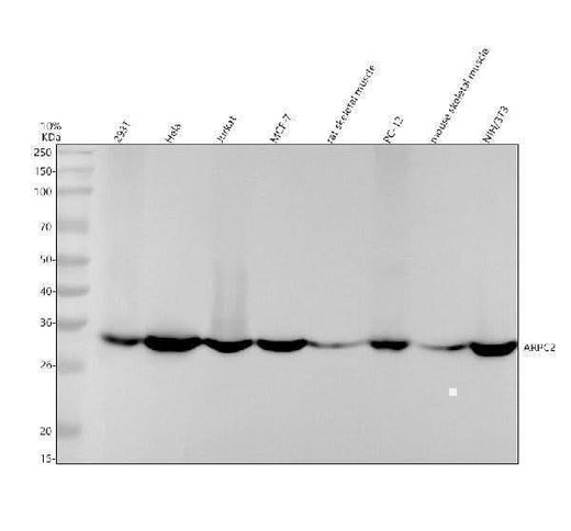 Anti-ARPC2 Rabbit Monoclonal Antibody Boster Bio