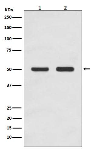 Anti-AP2M1/Ap 2 Mu 1 Rabbit Monoclonal Antibody Boster Bio