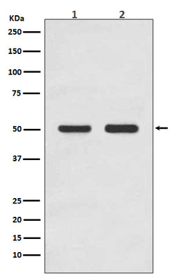 Anti-AP2M1/Ap 2 Mu 1 Rabbit Monoclonal Antibody Boster Bio