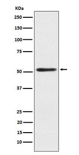 Anti-SRP54 Rabbit Monoclonal Antibody Boster Bio