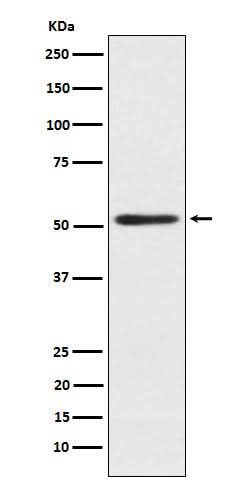 Anti-SRP54 Rabbit Monoclonal Antibody Boster Bio