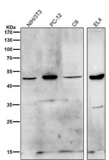 Anti-HDAC11/Histone Deacetylase 11 Rabbit Monoclonal Antibody Boster Bio