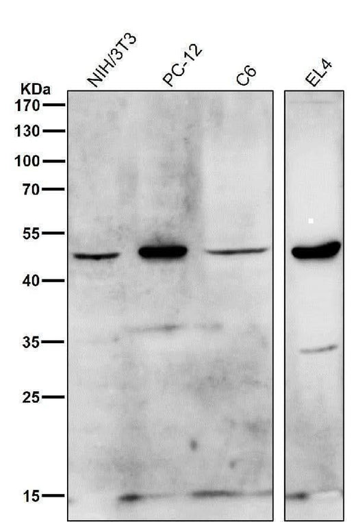 Anti-HDAC11/Histone Deacetylase 11 Rabbit Monoclonal Antibody Boster Bio