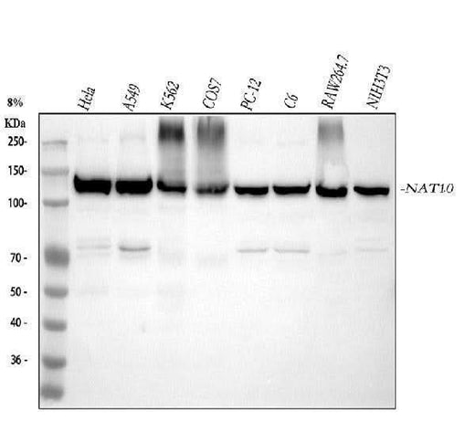 Anti-NAT10 Rabbit Monoclonal Antibody Boster Bio