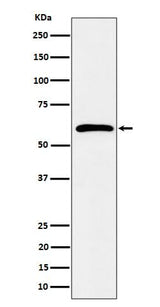 Anti-Syndecan 3 Rabbit Monoclonal Antibody Boster Bio