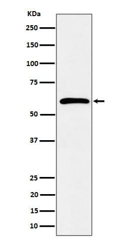 Anti-Syndecan 3 Rabbit Monoclonal Antibody Boster Bio