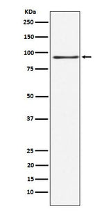 Anti-RANBP3 Rabbit Monoclonal Antibody Boster Bio